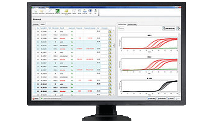 VESPERZ RealTime Analysis